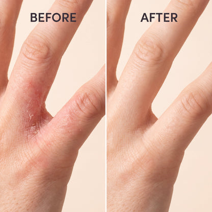 Anti-Fungal Skin Soap