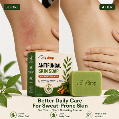 Anti-Fungal Skin Soap