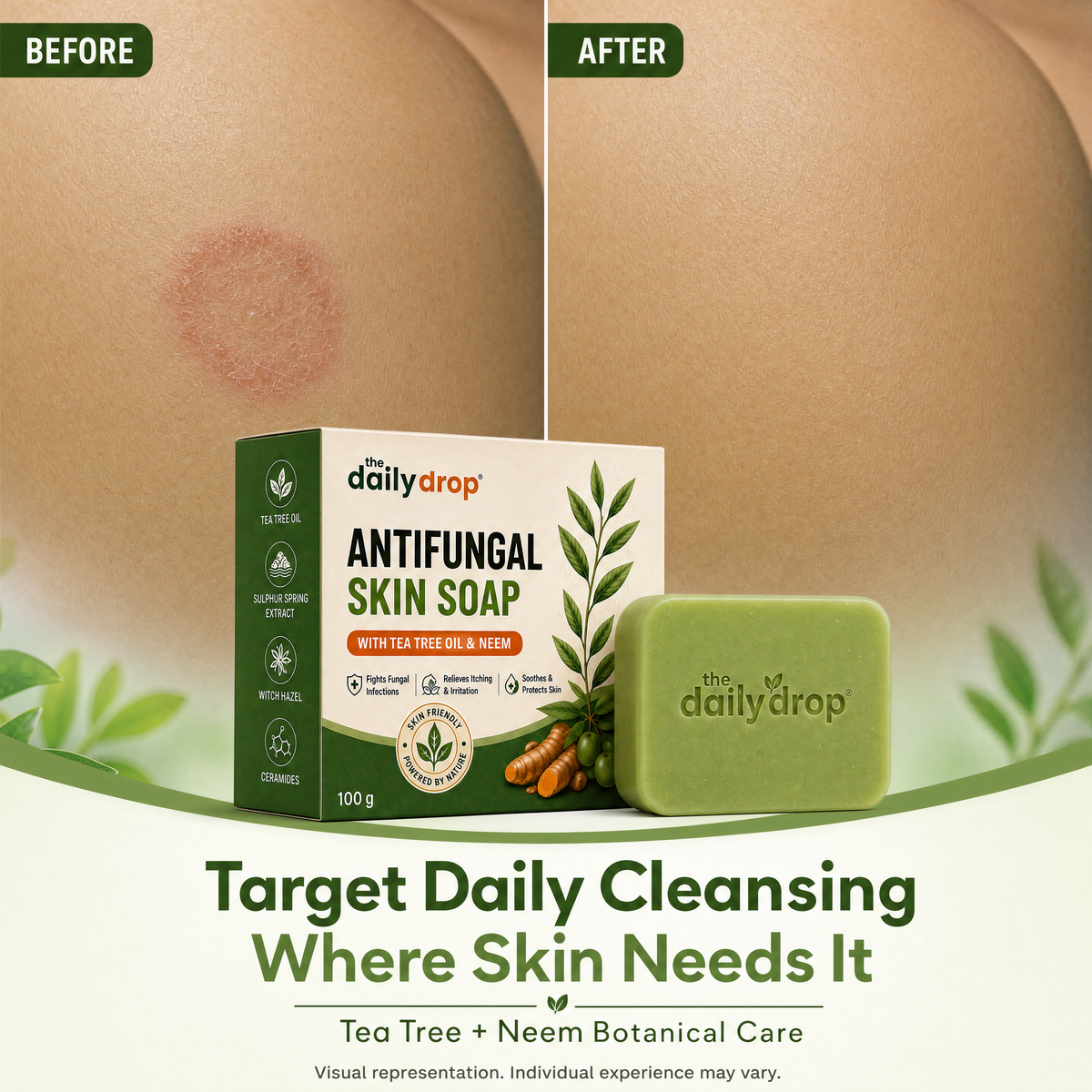 Anti-Fungal Skin Soap